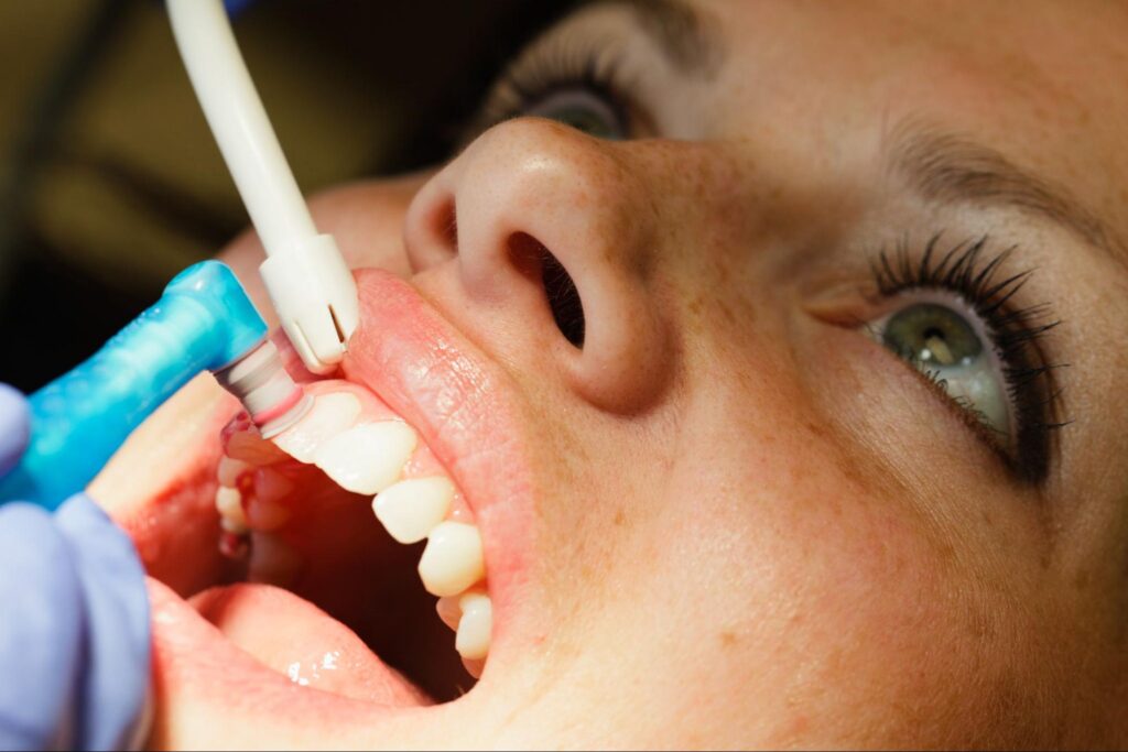 What Happens During a Dental Cleaning?