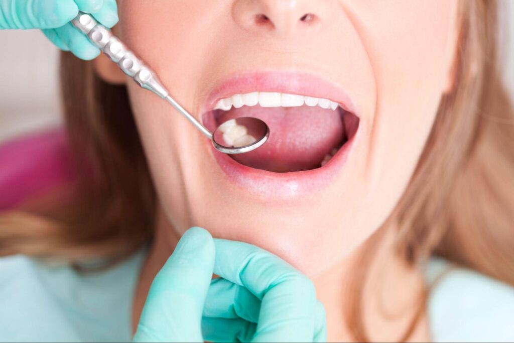 What To Expect From a Dental Filling